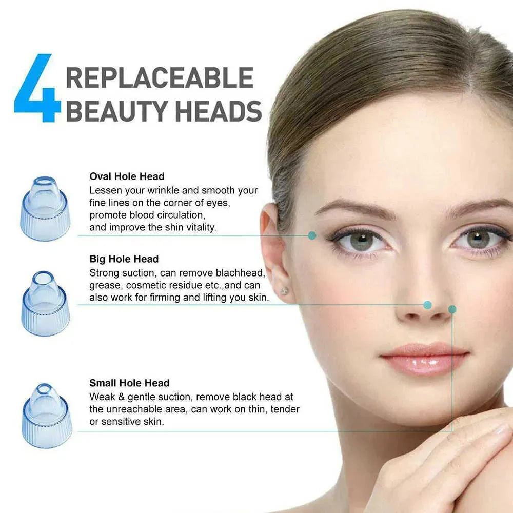 Vacuum Blackhead Remover Face Black Spots Cleaner White Dot Pimple Removal