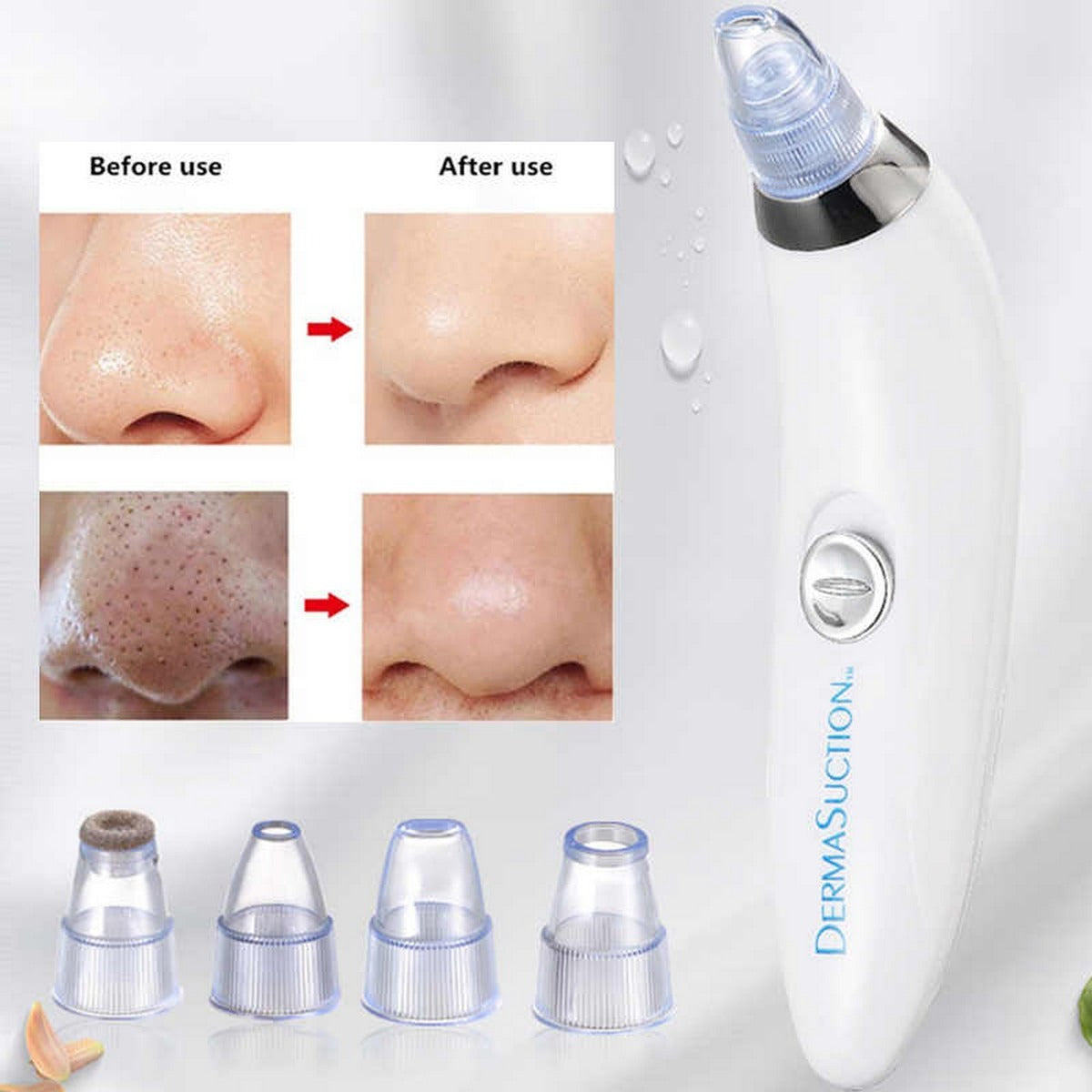 Vacuum Blackhead Remover Face Black Spots Cleaner White Dot Pimple Removal