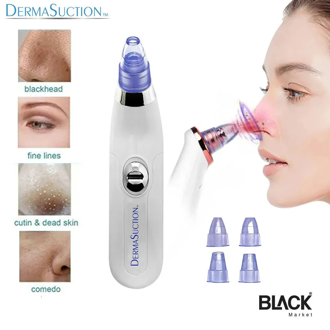 Vacuum Blackhead Remover Face Black Spots Cleaner White Dot Pimple Removal